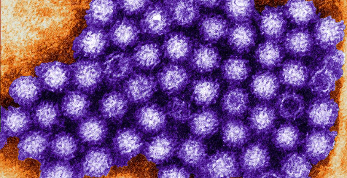 Purple norovirus microbes viewed through a microscope